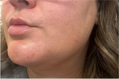 Androgen Blocker Plus for PCOS 20 Image Placeholders 3